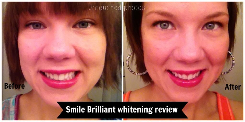 Review LED teeth whitening at home by Smile Brilliant My Life A
